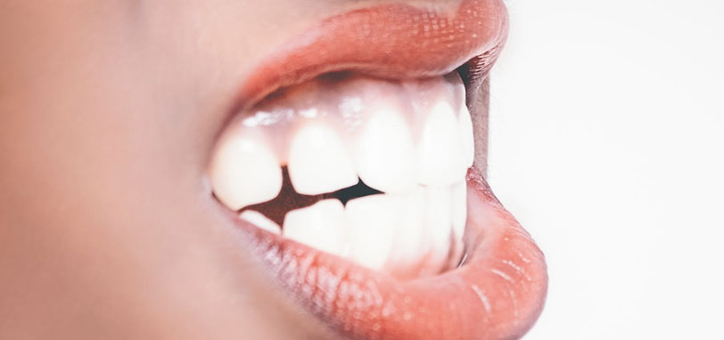 dientes apiñados tratamiento